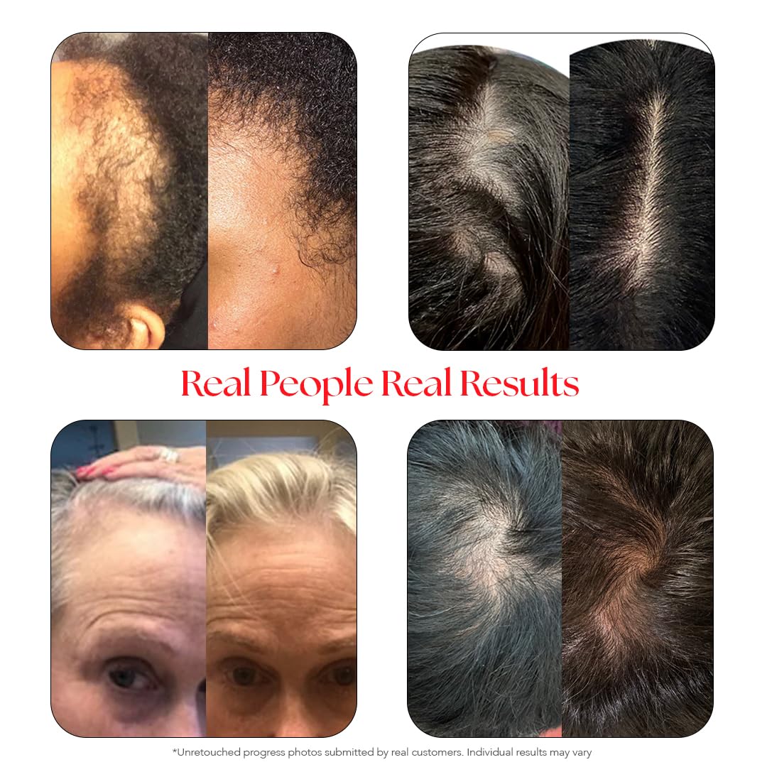 HAIRtamin Gorgeous Growth Travel Scalp Serum Natural Hair Growth Thickening Treatment | Visibly Increases Thicker Looking Hair And Promotes Scalp Health | Nourishes & Hydrates Dry, Itchy Scalp